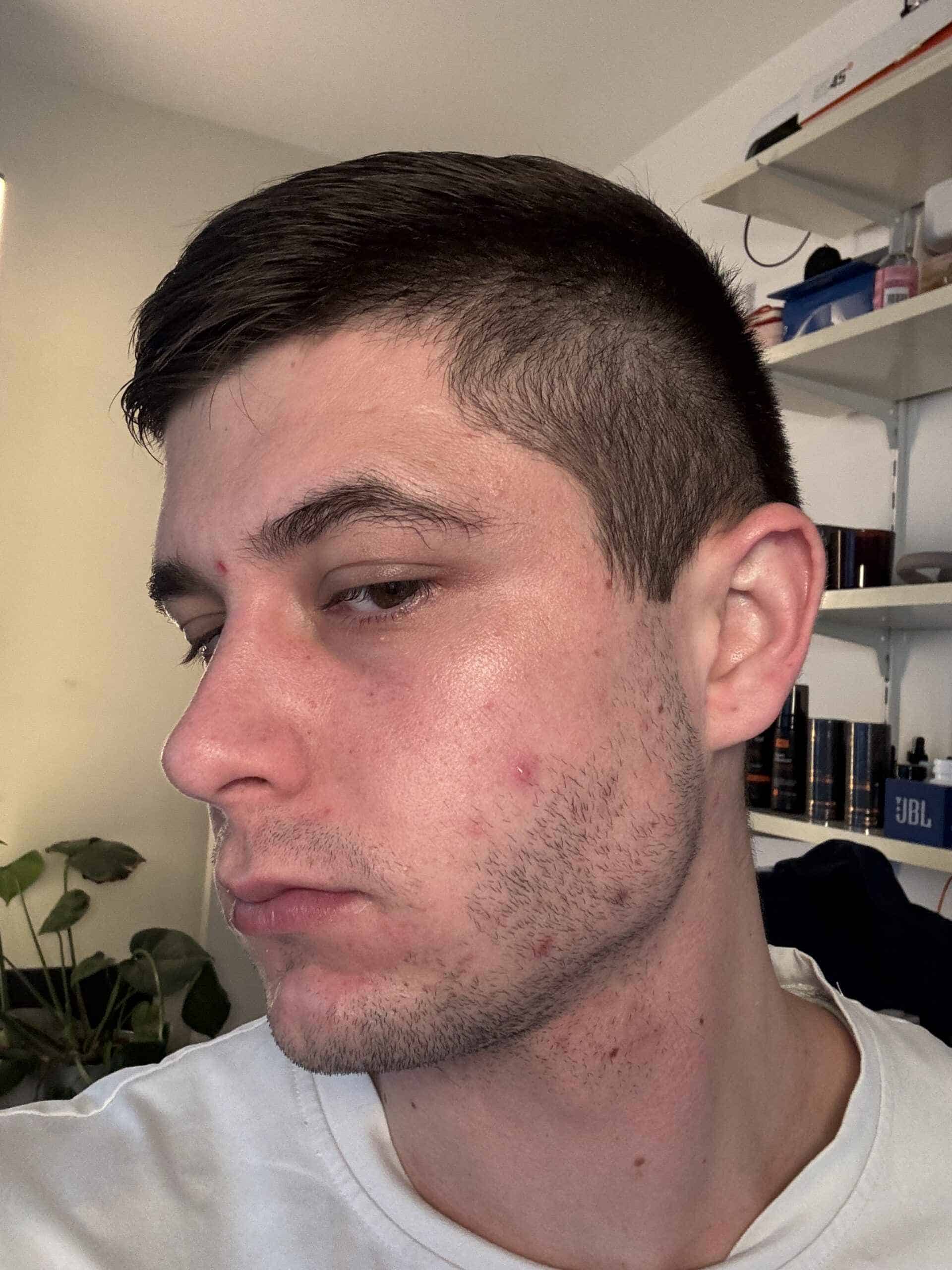 mitovitan before