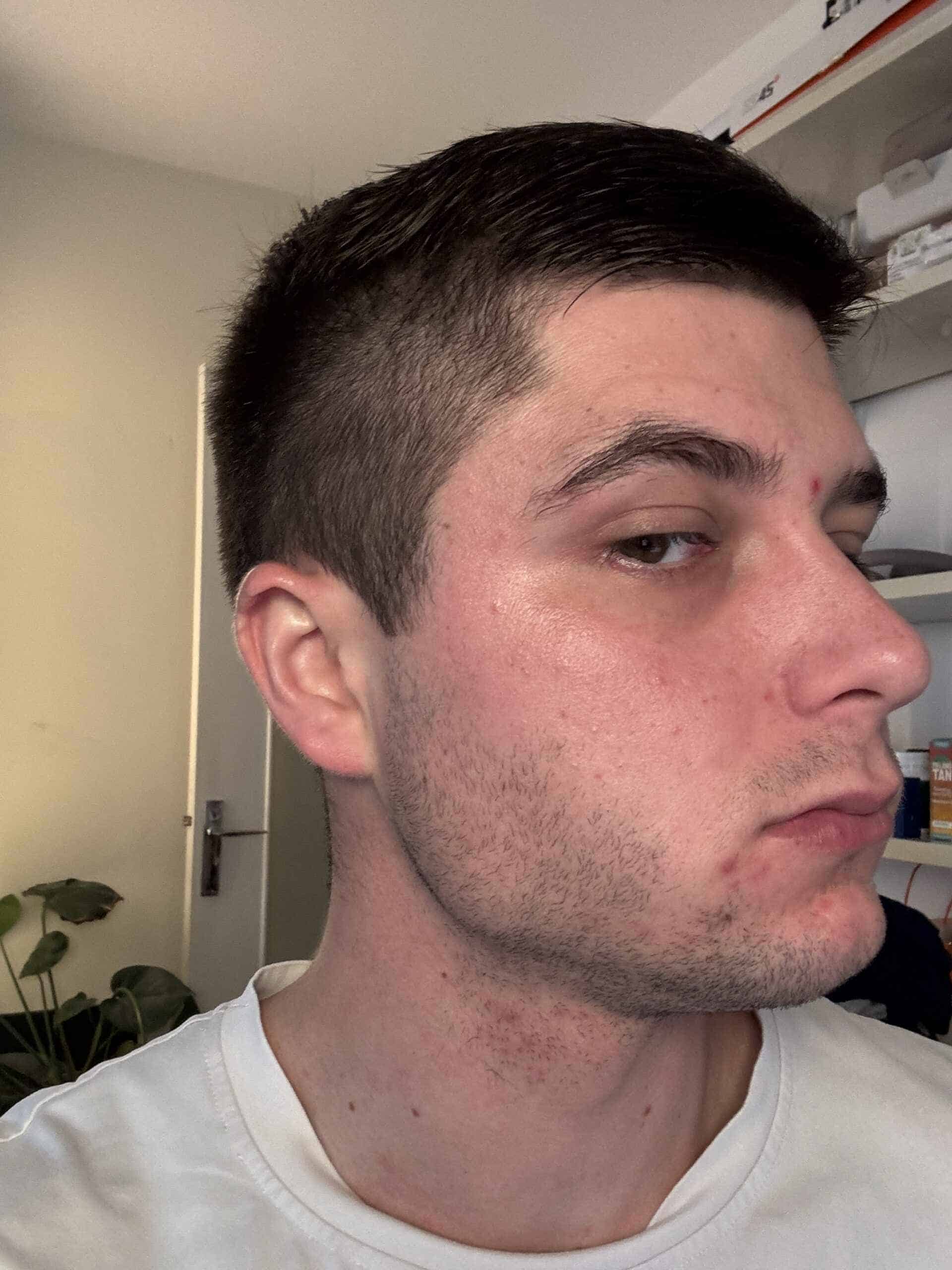 mitovitan before